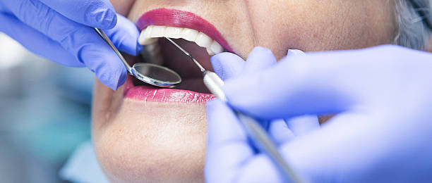 Best Emergency Dentist for Lost Fillings or Crowns in Yorketown, NJ